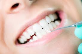 teeth whitening