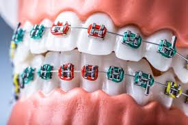 orthodontics